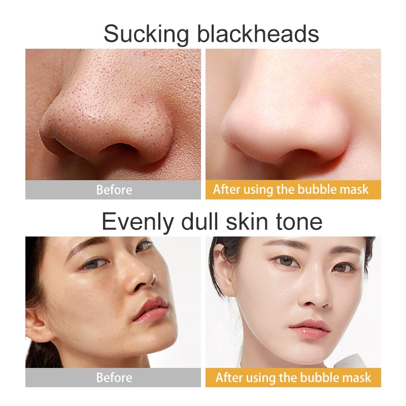 Silk Protein Hydrating Bubble Mask